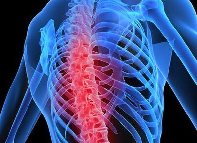 torakka umurtqa pog'onasi osteokonrozi