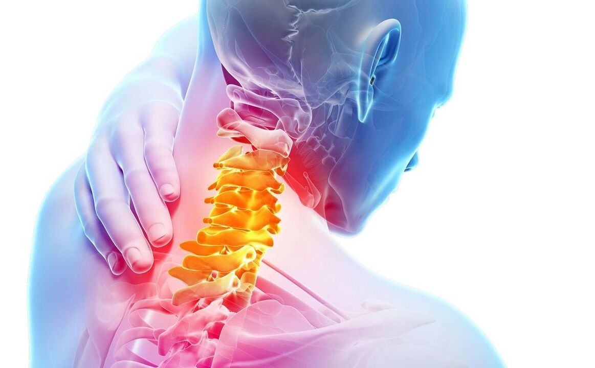 servikal osteoxondroz bilan og'riq
